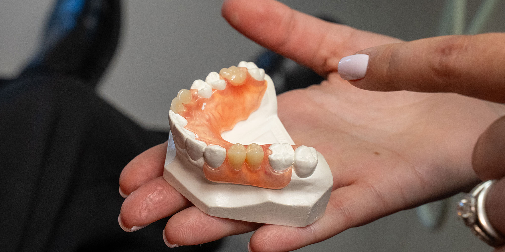 close up of a model with crowns planted